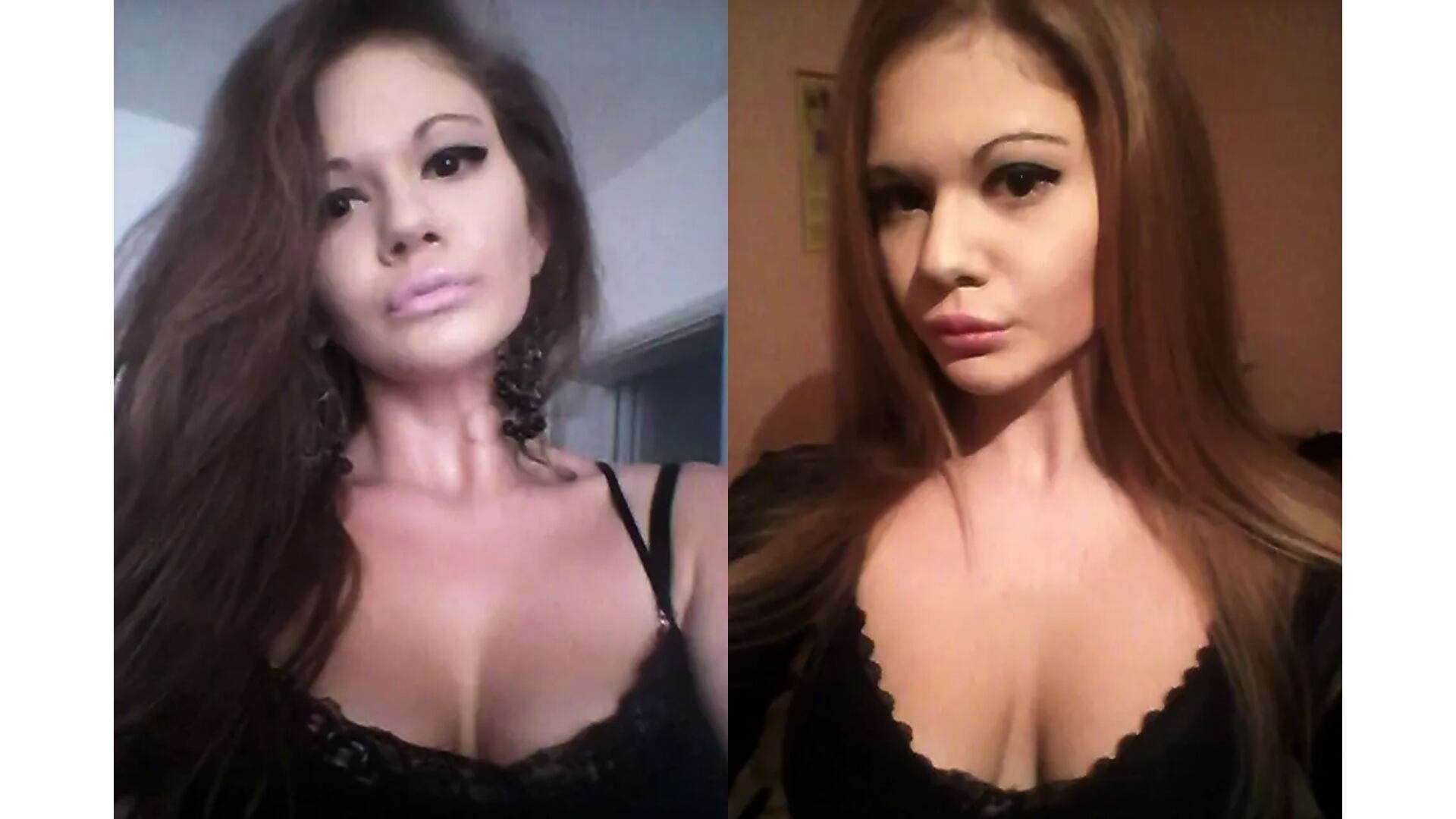 Así lucía la mujer con los labios más grandes del mundo antes de su cirugía. Foto: Especial (IG/@andrea88476)