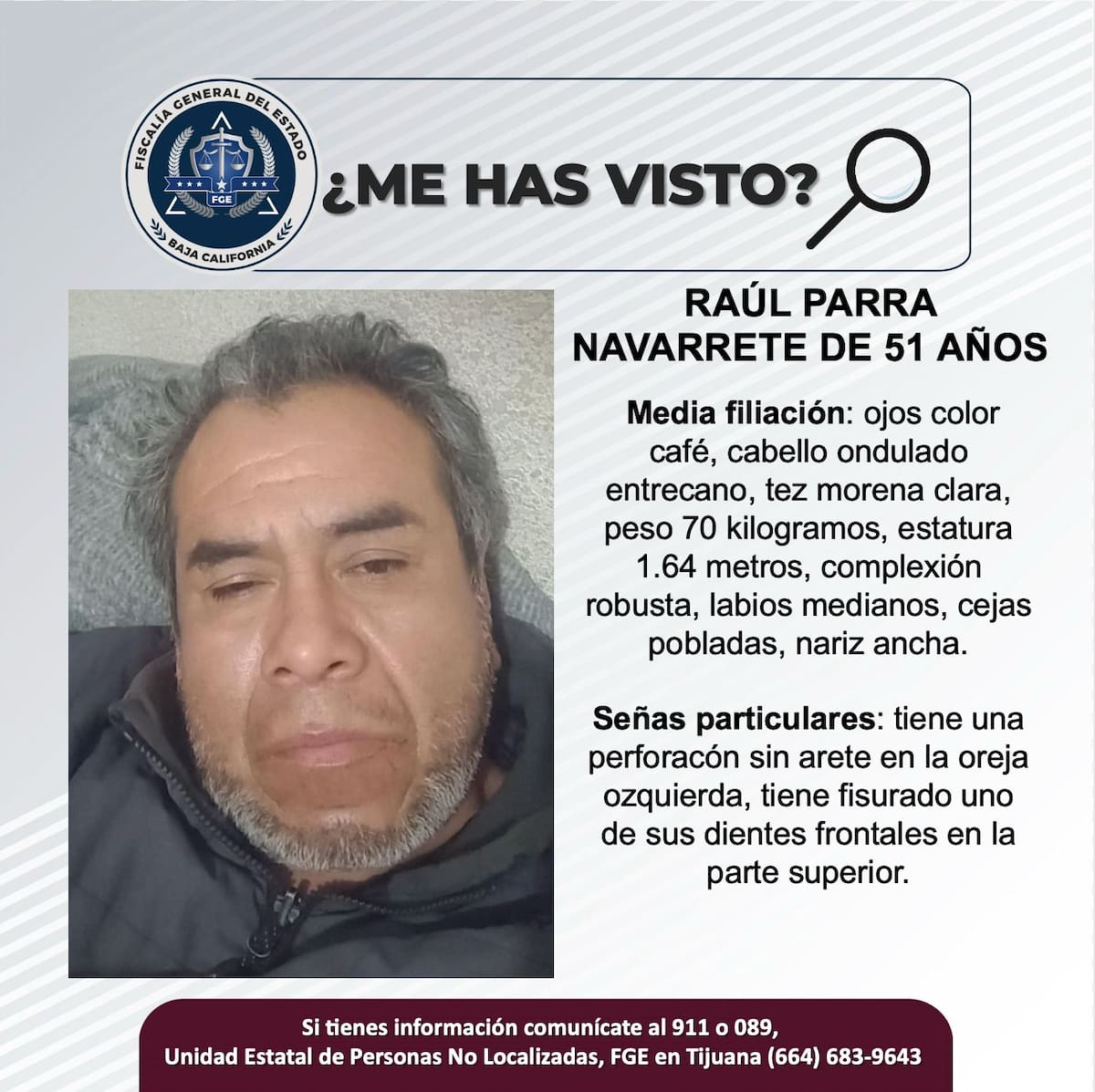 Raúl Parra Navarrete tiene una perforacón sin arete en la oreja izquierda y una fisura en la parte superior de uno de sus dientes.