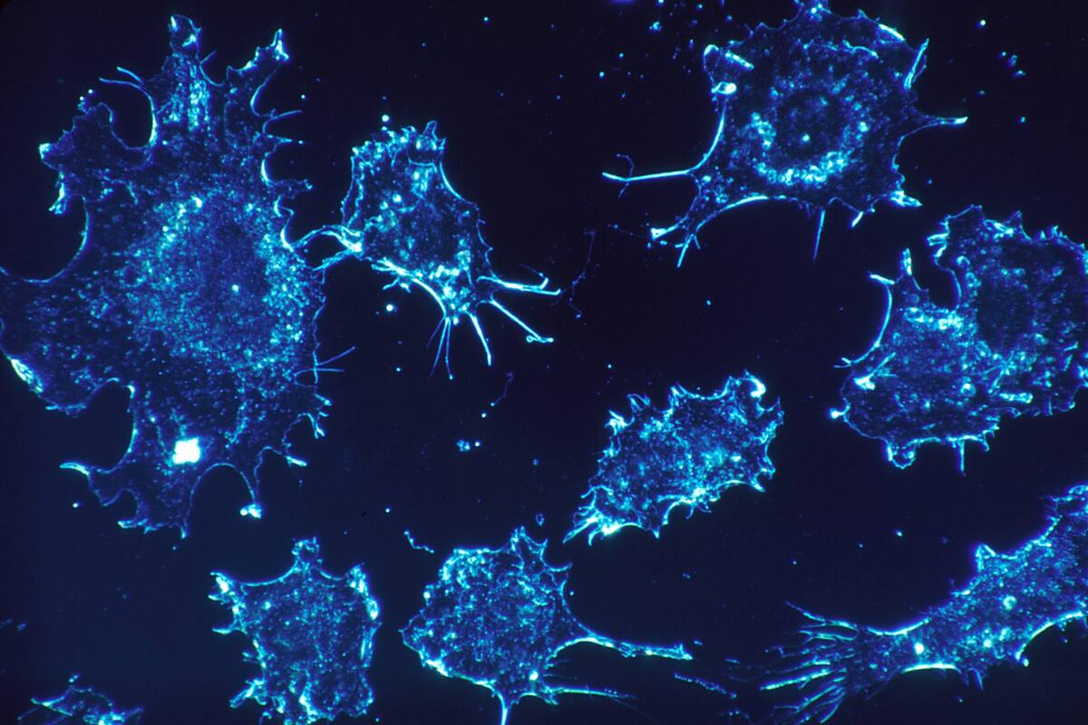 ¿Por qué el cáncer es tan difícil de curar?