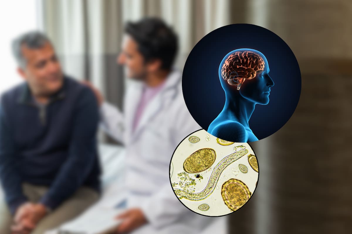 Tras sufrir severas migrañas, un hombre acudió al médico y descubrió que tenía parásitos en el cerebro por consumir tocino crudo