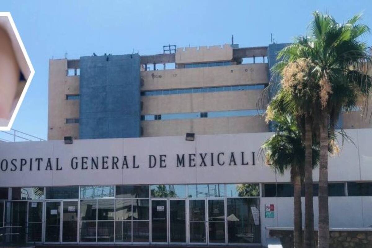 Muere bebé en HG; tenía síndrome de maltratado