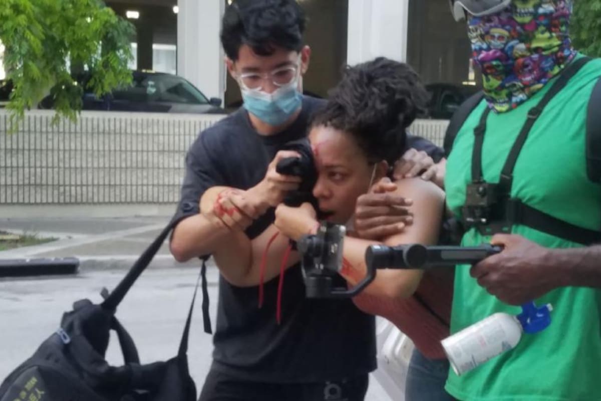 Protestas en EU: Piden investigar disparos con "balas de goma" al rostro de una mujer que dejaron desfigurado