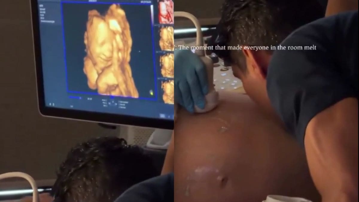 Ecografía capta a un bebé que parece sonreír cuando su papá le da un beso al vientre de su madre