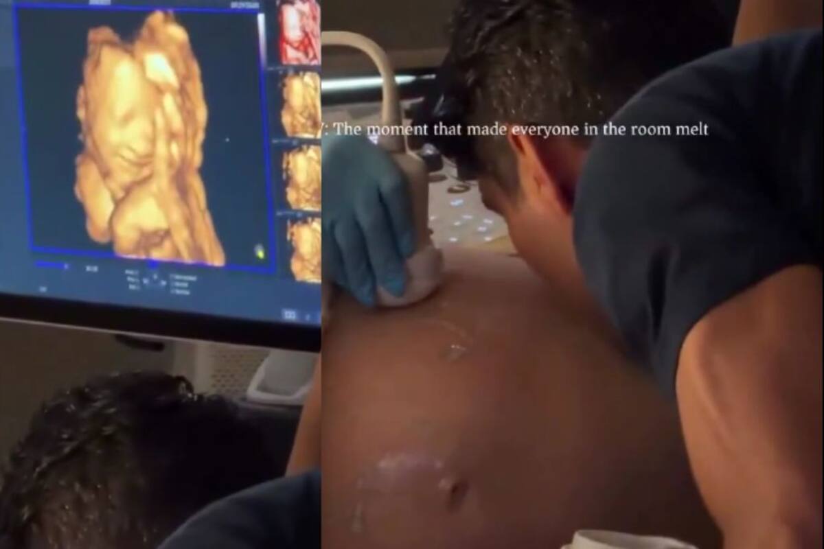 Ecografía capta a un bebé que parece sonreír cuando su papá le da un beso al vientre de su madre