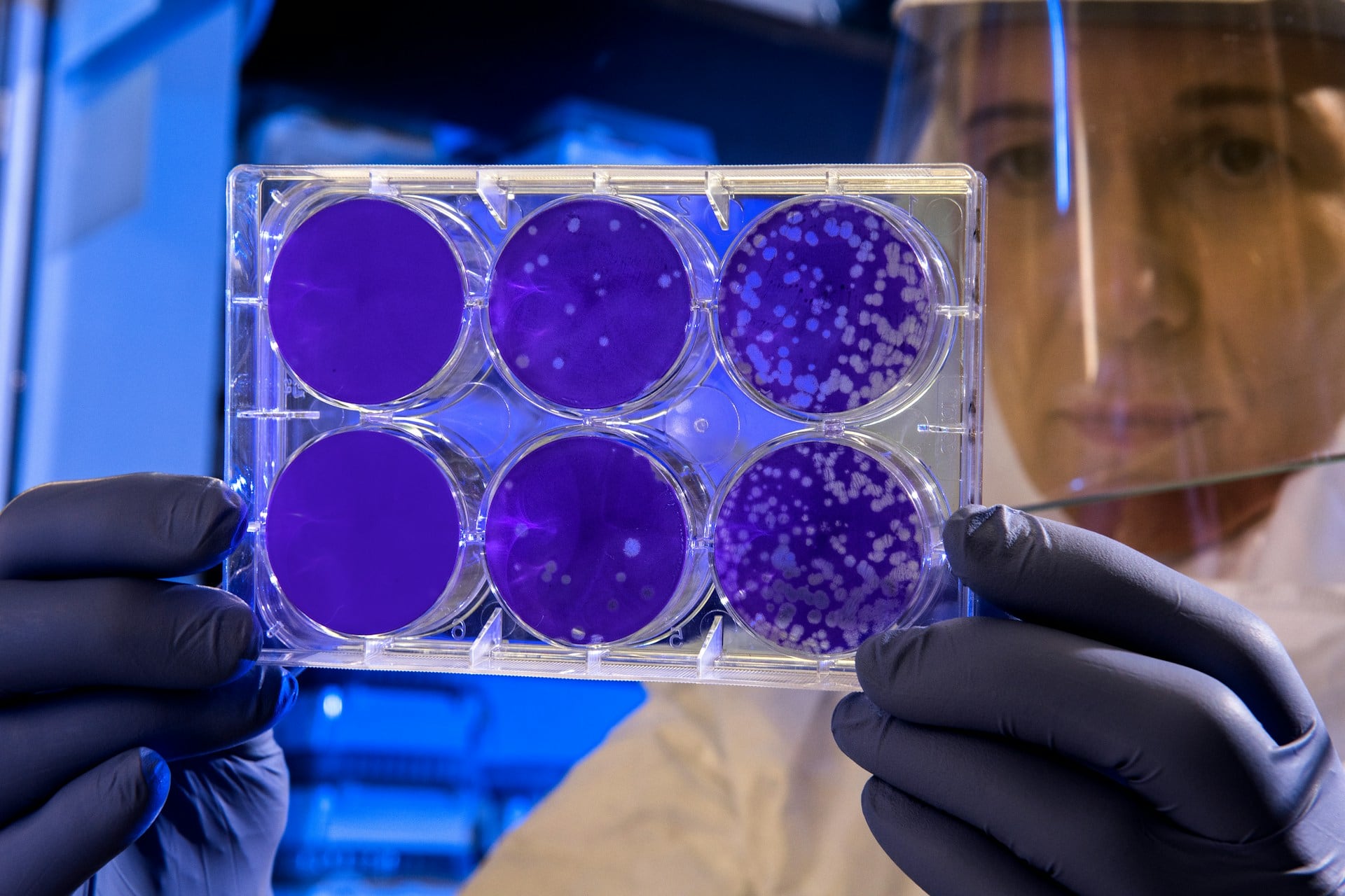 Los médicos locales están siendo capacitados para reconocer los síntomas de la peste bubónica y tomar las medidas necesarias. FOTO: CDC/UNSPLASH