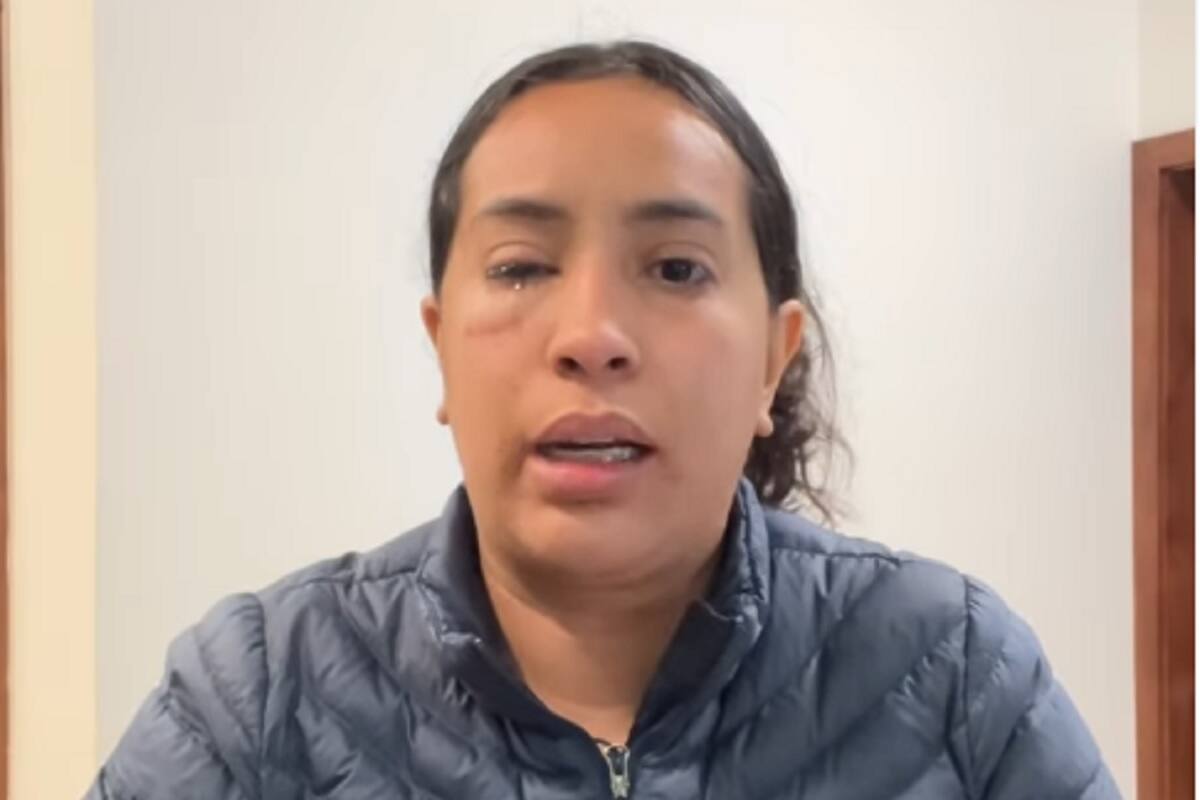 Influencer tijuanense denuncia agresión con ácido