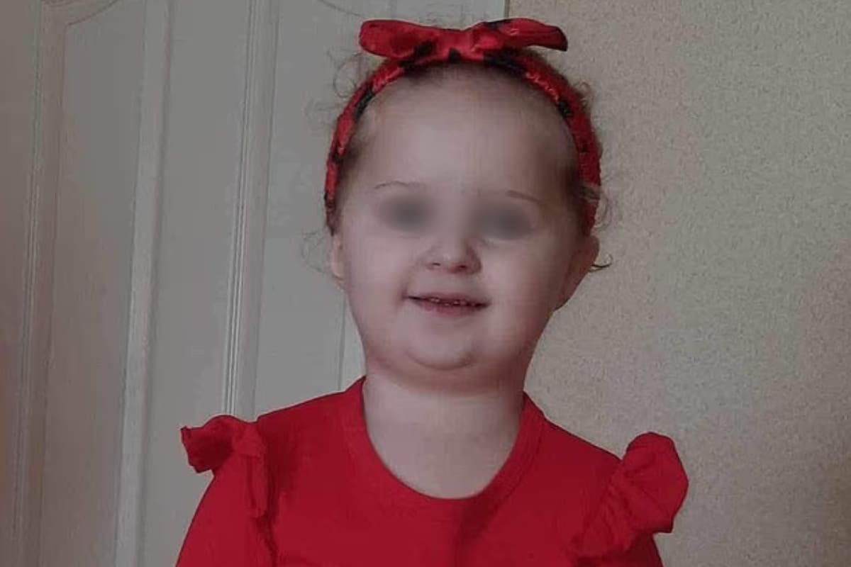 Niña de 3 años muere por piojos luego de que sus padres permitieran que la infestación empeorara tanto que le provocó anemia