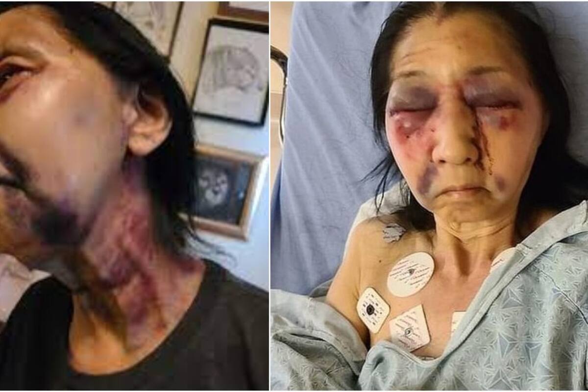 Abuelita mexicana de 70 años sufre brutal golpiza en ataque racial por mujer afroamericana que la confunde con asiática en Eagle Rock, California