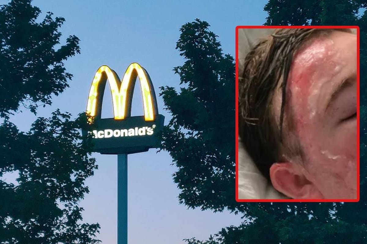 Jacob, un joven empleado de McDonald’s en California, queda hospitalizado tras presunto ataque con aceite caliente de un compañero en su rostro; piden apoyo a través de plataformas