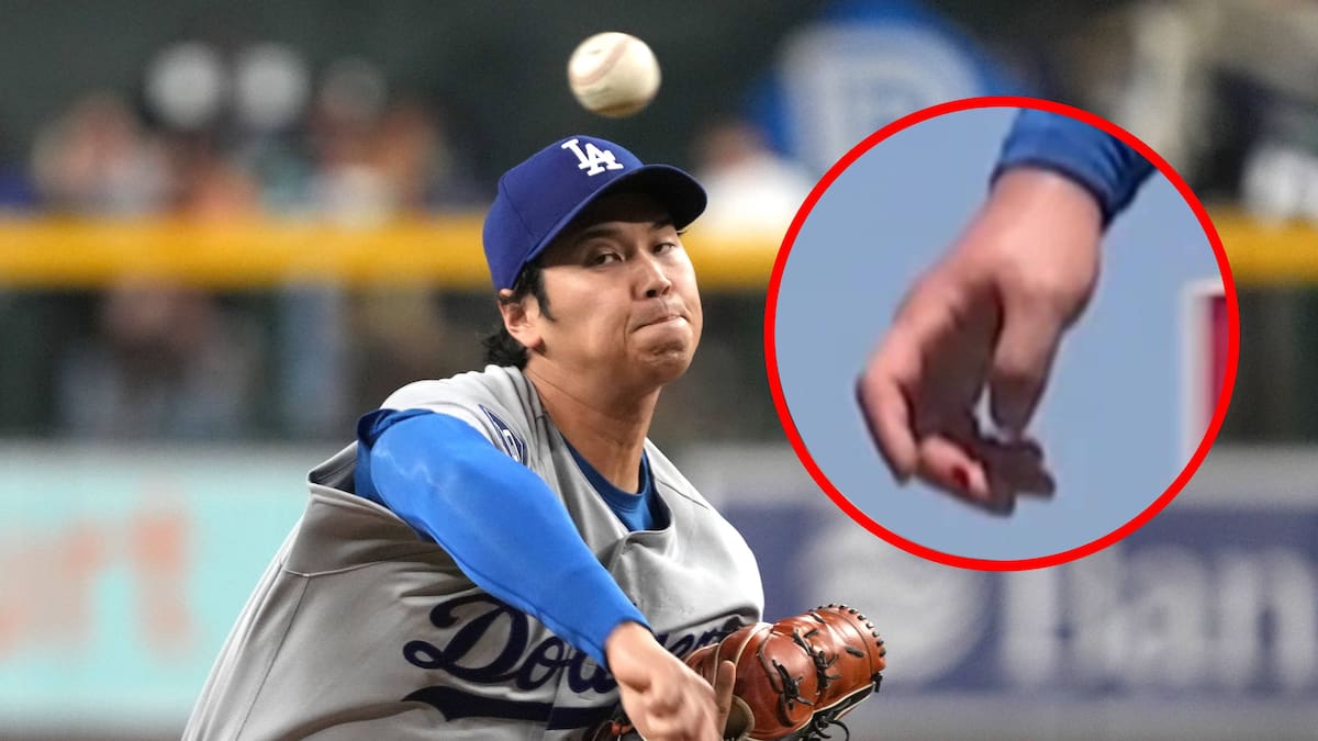 Shohei Ohtani jugó con dolor en la rodilla y con una ampolla en la mano que empezó a sangrar mientras pitchaba en el Dodgers vs Rays