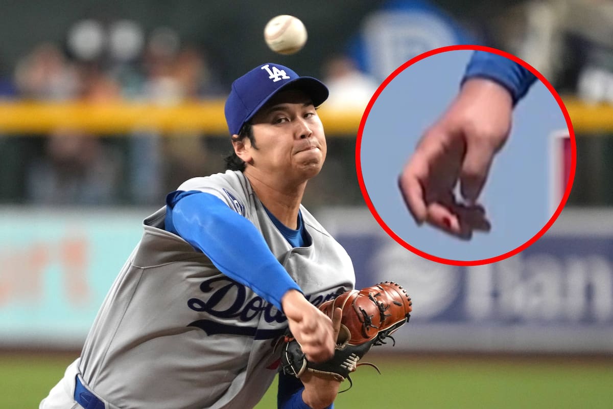 Shohei Ohtani jugó con dolor en la rodilla y con una ampolla en la mano que empezó a sangrar mientras pitchaba en el Dodgers vs Rays