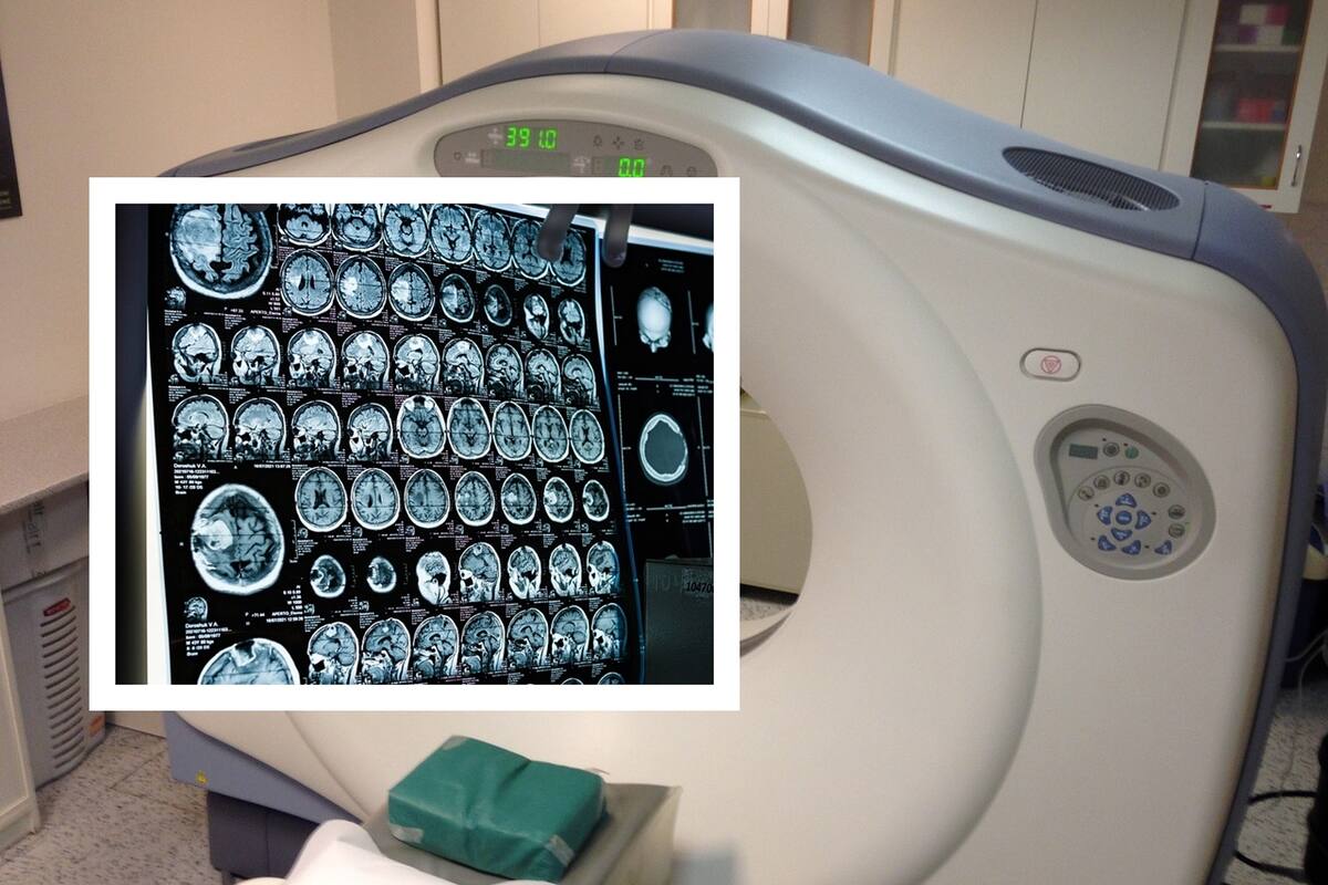 Aseguran sí funciona tomógrafo del Oncológico de Sonora