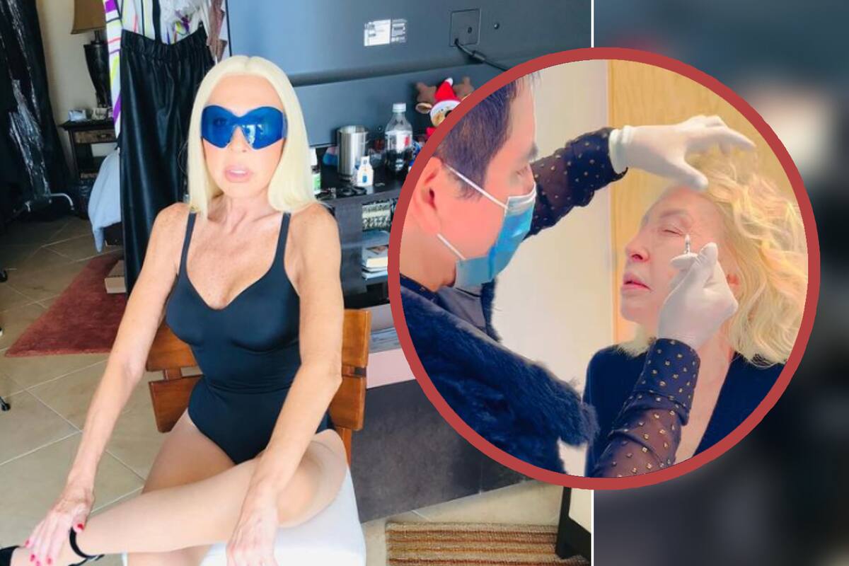 VIDEO: Laura Bozzo muestra cómo se inyecta bótox en el rostro aunque le duela mucho