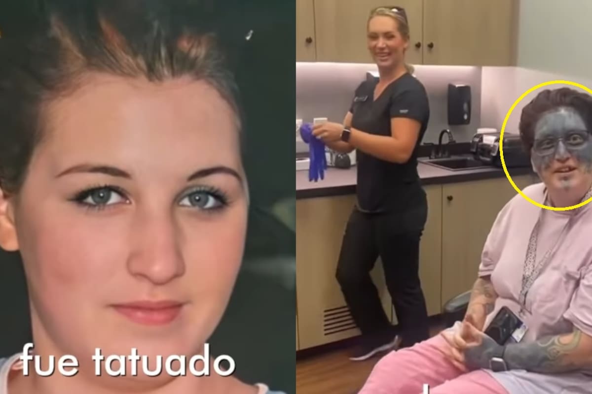 “Ahora, a los 36, un médico le devolvió la esperanza”: mujer vivió 16 años con el rostro tatuado por su exnovio y busca recuperarlo