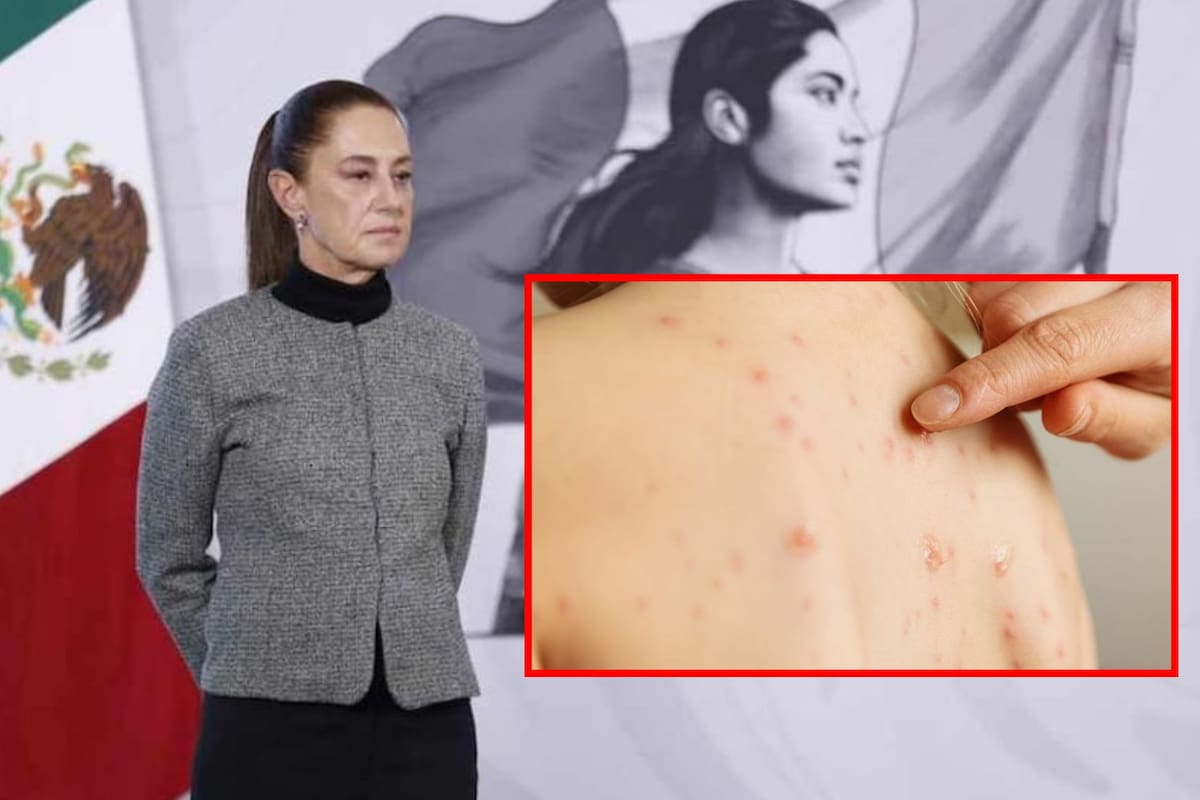 Casos de sarampión no ceden en México; autoridades advierten que es uno de los virus más contagiosos y refuerzan llamado a vacunarse