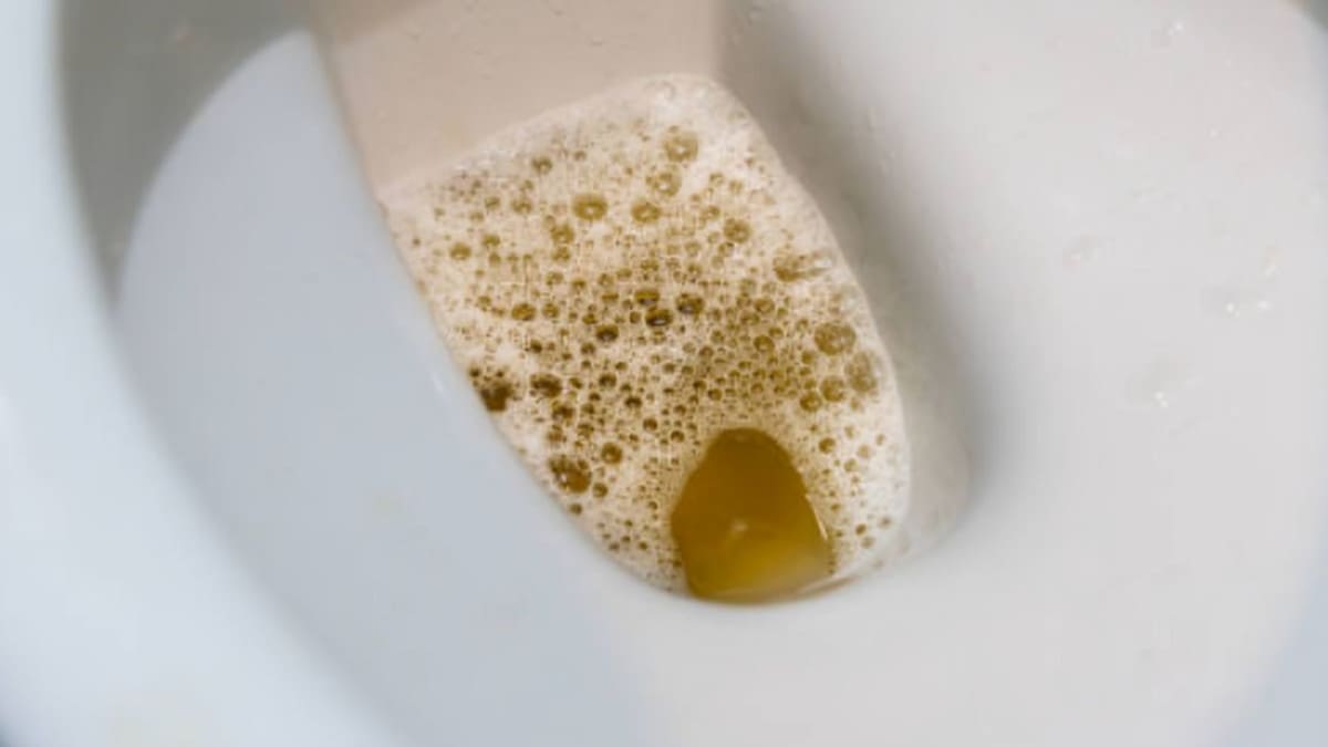 Burbujas en la orina: qué significa para tu salud renal y qué alimentos ayudan a proteger tus riñones