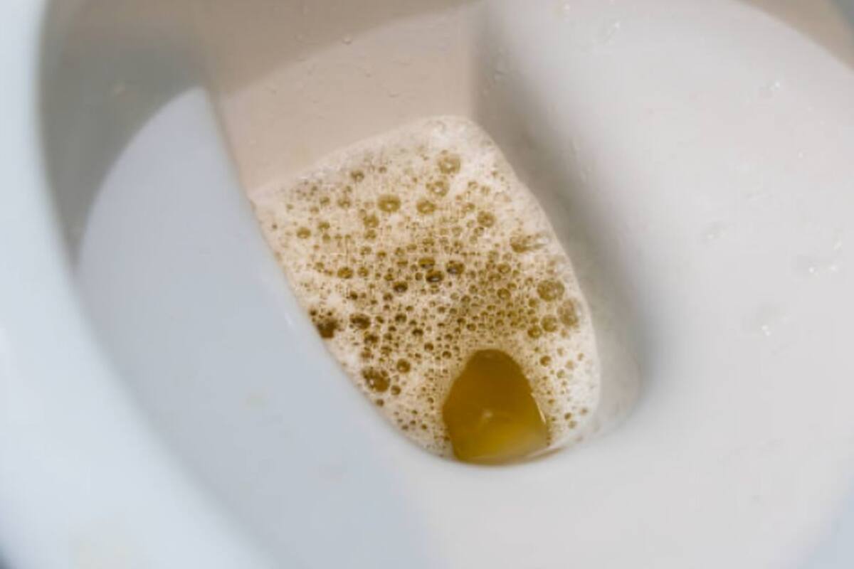Burbujas en la orina: qué significa para tu salud renal y qué alimentos ayudan a proteger tus riñones