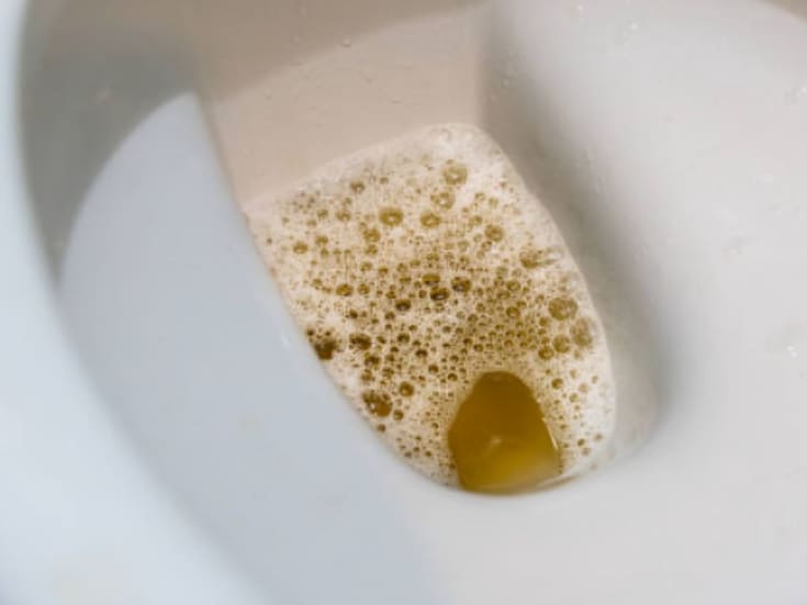 Burbujas en la orina: qué significa para tu salud renal y qué alimentos ayudan a proteger tus riñones