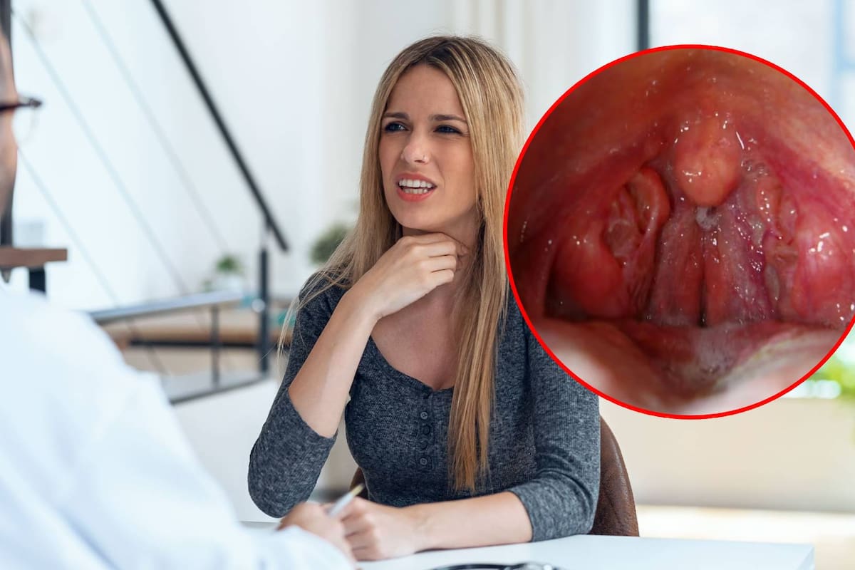 ¿Por qué te duele la garganta? Conoce la faringitis estreptocócica, la bacteria de esta época del año