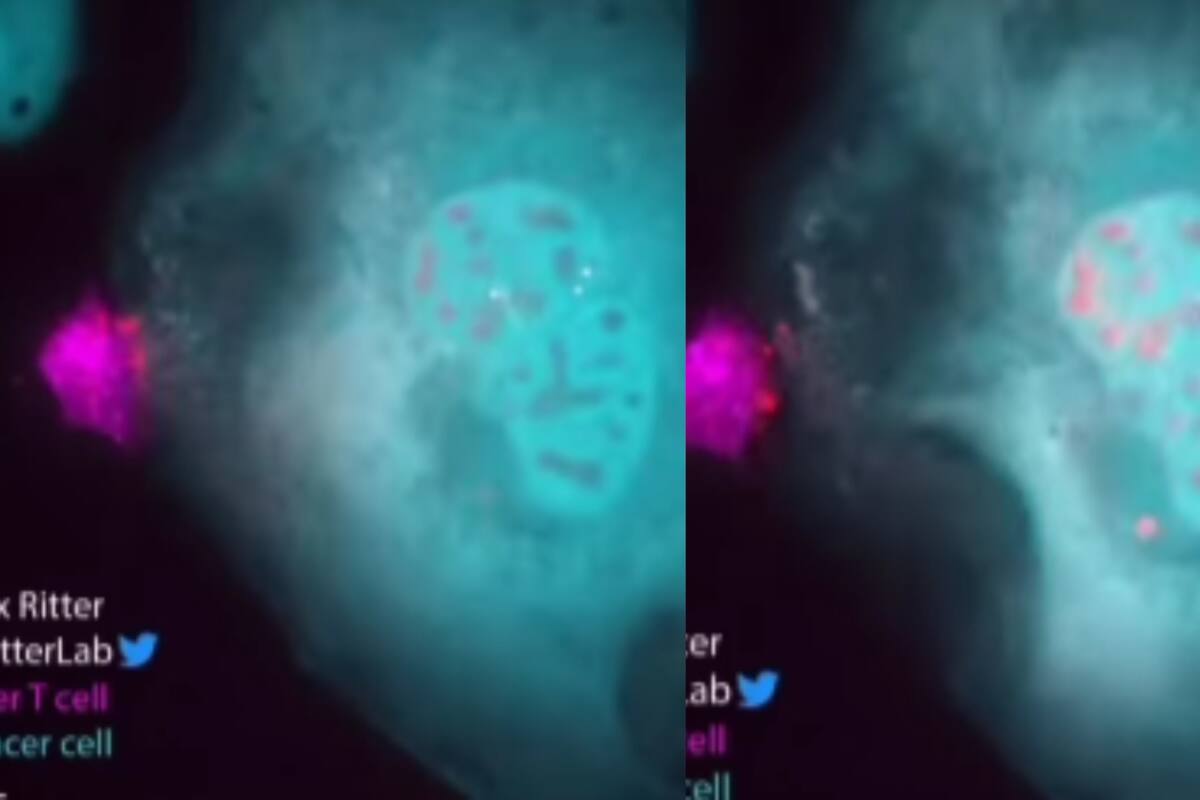 Impresionante: Así ataca una célula inmune a una cancerígena hasta destruirla por completo