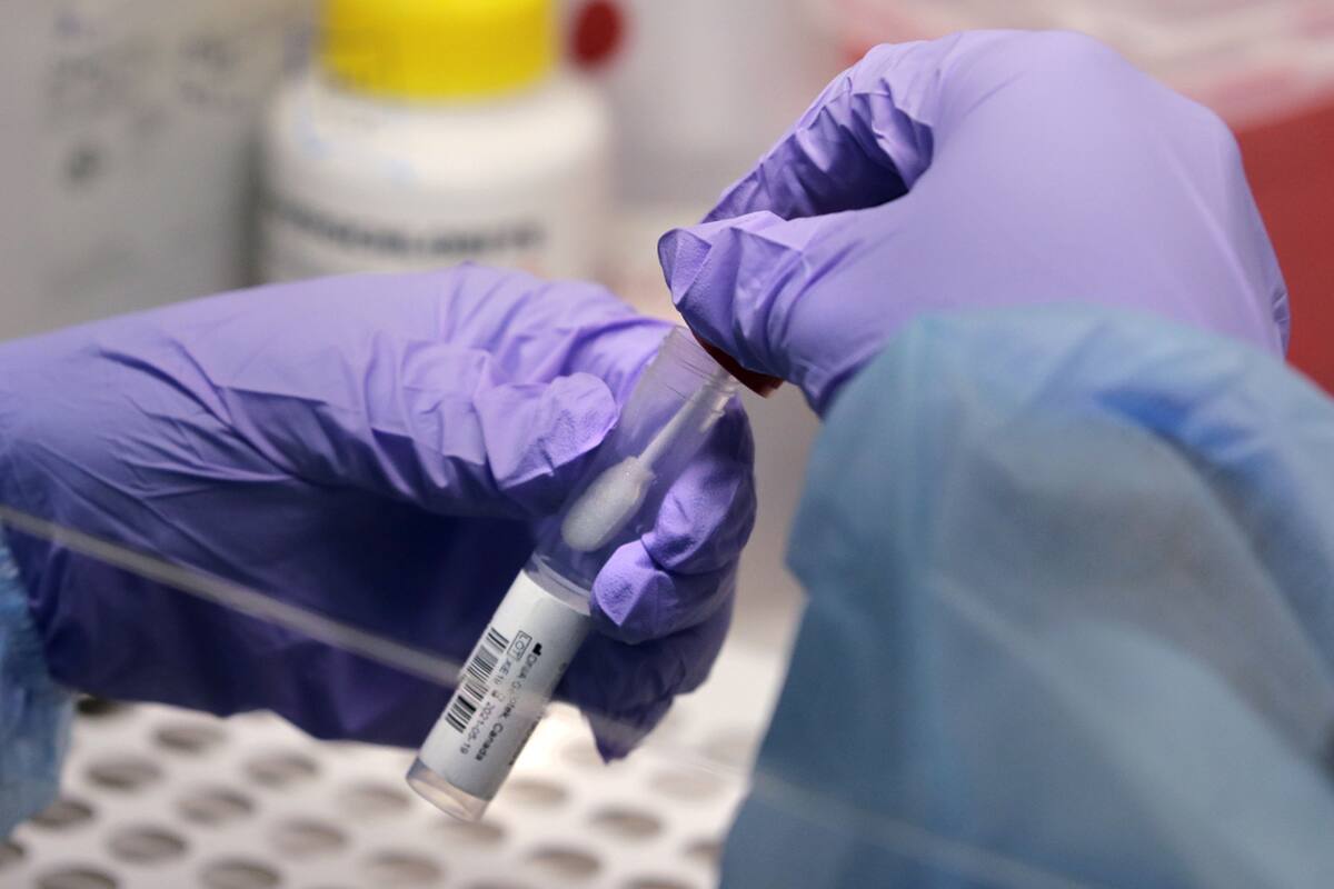 BC no registra casos de la variante Ómicron de Covid-19: Secretaría de Salud