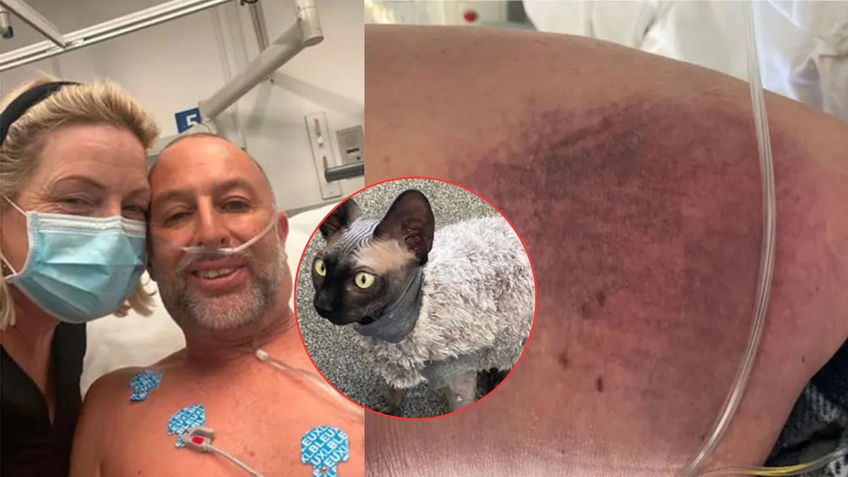 Un hombre tropezó con su gato y cayó 14 escalones: sobrevivió con fractura de cráneo, cuello roto y nueve costillas fracturadas tras pasar 14 horas inmóvil en su propia casa