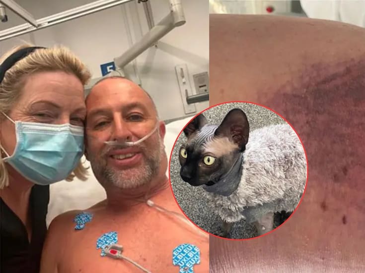 Un hombre tropezó con su gato y cayó 14 escalones: sobrevivió con fractura de cráneo, cuello roto y nueve costillas fracturadas tras pasar 14 horas inmóvil en su propia casa