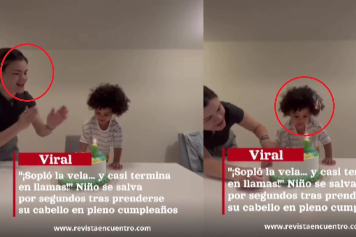 IMPACTO: Menor se incendia el cabello mientras apagaba la vela de su pastel de cumpleaños