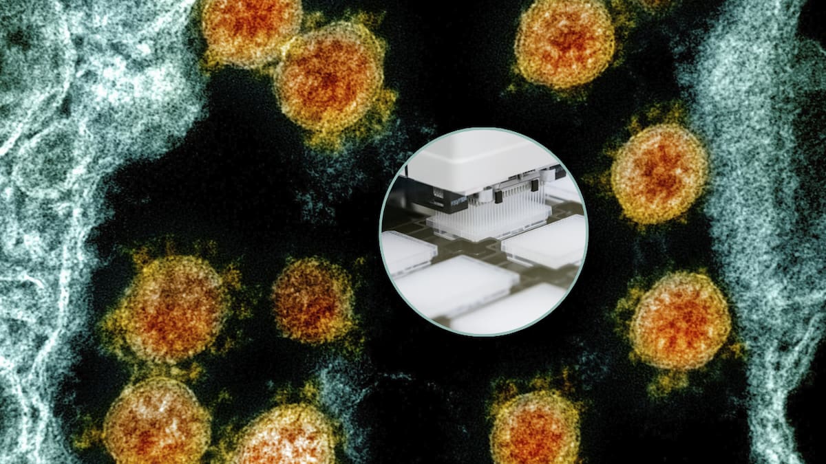 Una inteligencia artificial logró crear por primera vez virus funcionales desde cero, un avance que podría ayudar a combatir infecciones resistentes a antibióticos y obliga a replantear los límites de la bioseguridad