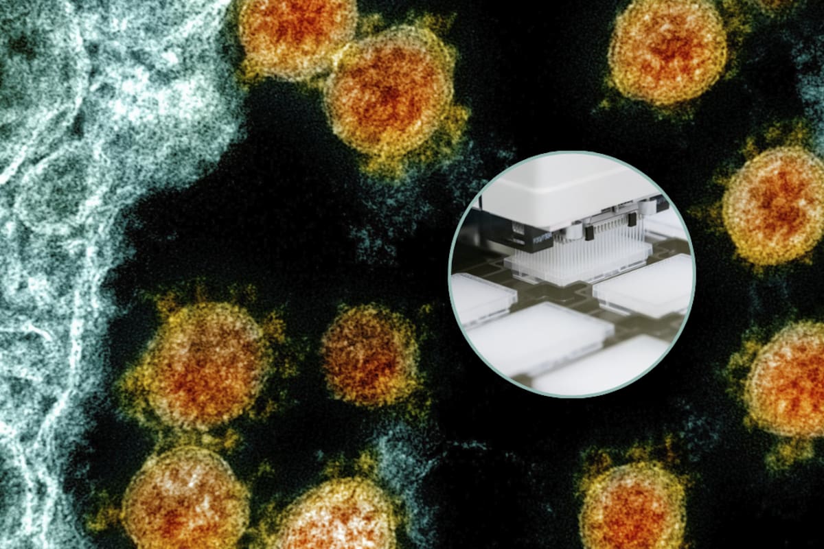 Una inteligencia artificial logró crear por primera vez virus funcionales desde cero, un avance que podría ayudar a combatir infecciones resistentes a antibióticos y obliga a replantear los límites de la bioseguridad