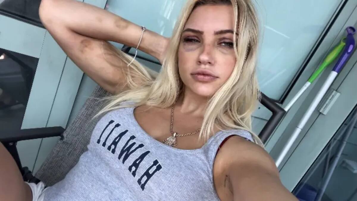 Cirujano plástico de Nueva York acusado de convertir a modelo en 'esclava sexual'. FOTO: NY Post