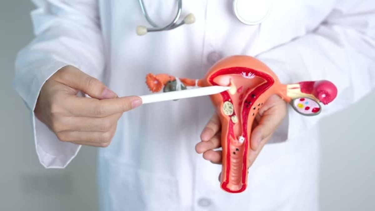 El VPH es el responsable directo de más del 90% de los casos de cáncer cervicouterino en mujeres Foto: istock