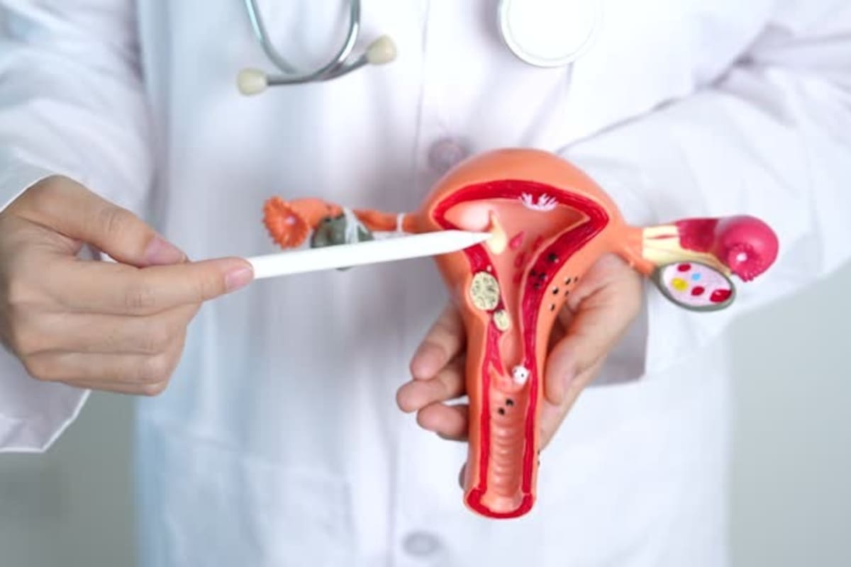 Disminuye 49% mujeres con cáncer cervicouterino