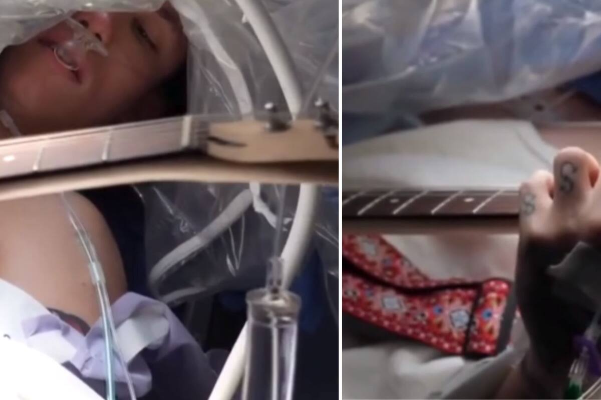 VIDEO: Hombre toca la guitarra mientras se encuentra en quirófano para extraerle un tumor cerebral