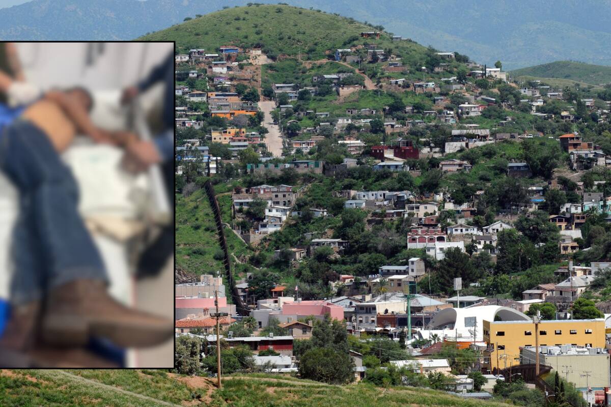 Bala perdida lesiona a niño en Nogales