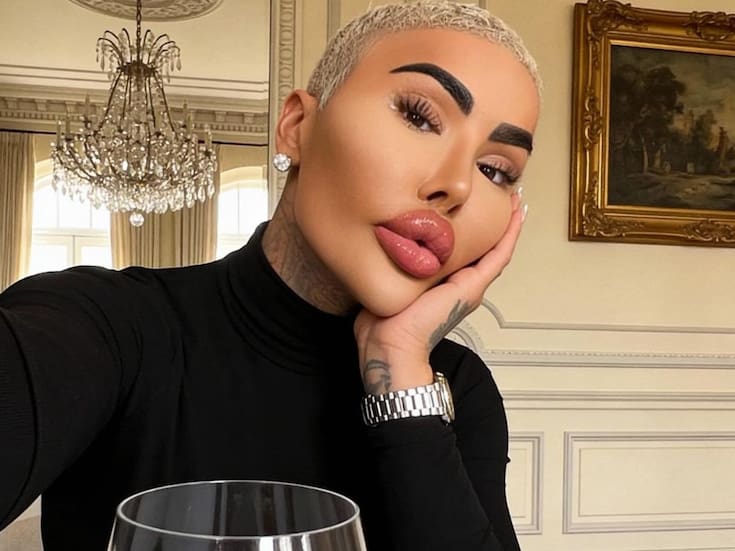 Encuentran sin vida a Jordan James Parke, influencer y estrella de ‘Botched’ en Londres: su muerte ha sido catalogada como “inexplicable” por la Policía Metropolitana