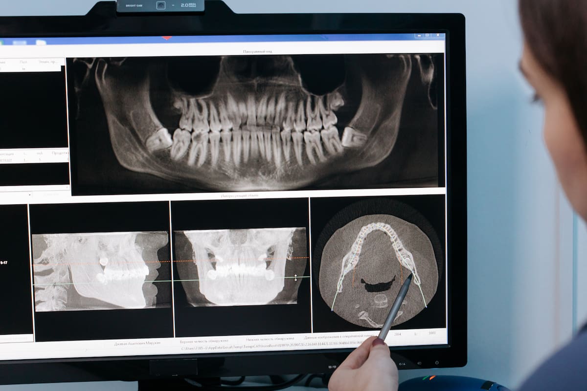 Dolor de mandíbula: por qué aparece y qué puede hacer para aliviarlo