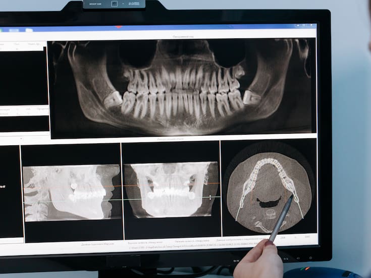 Dolor de mandíbula: por qué aparece y qué puede hacer para aliviarlo