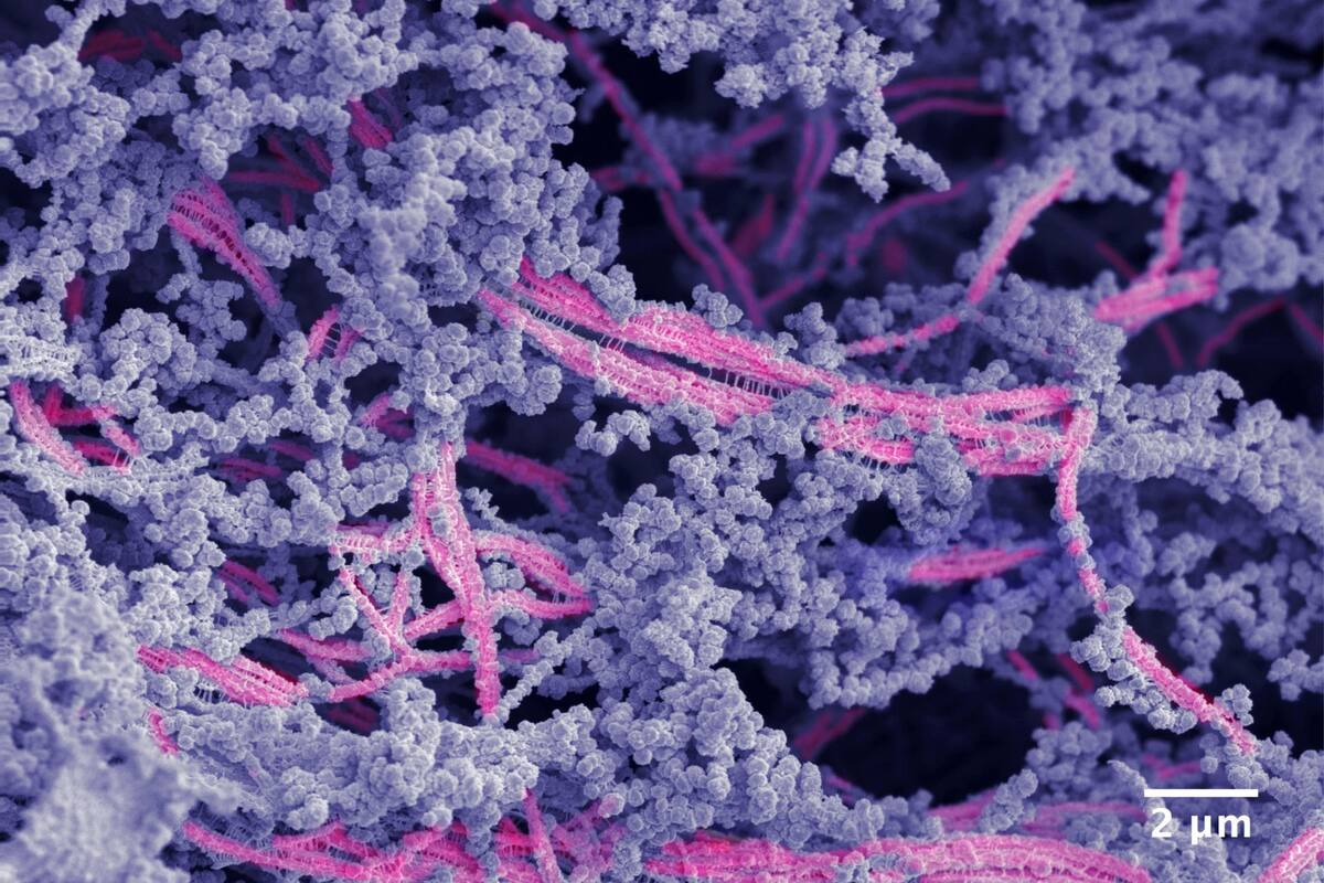 Generan biomaterial que puede reparar el cartílago de las articulaciones