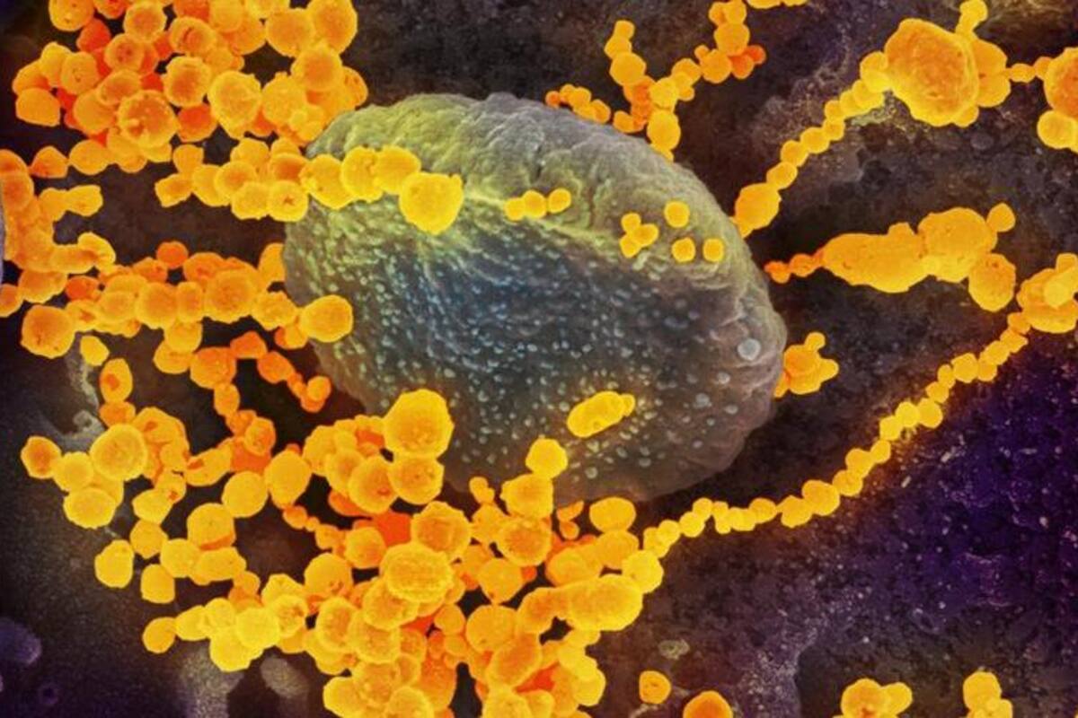 Confirman caso de coronavirus COVID-19 en Argelia; es un ciudadano italiano