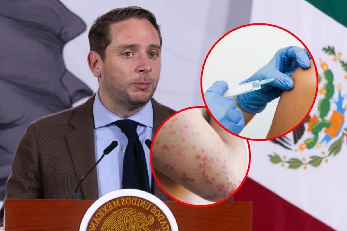 Casos activos de sarampión bajan 30% en México; Salud llama a no bajar la guardia y continuar vacunación