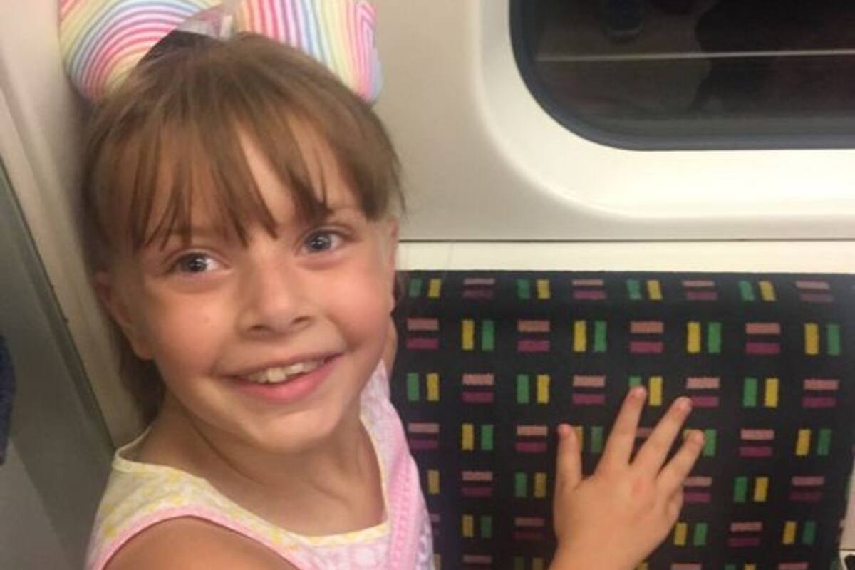 Perro le arranca el labio a niña, su madre quita los espejos para evitar que se vea