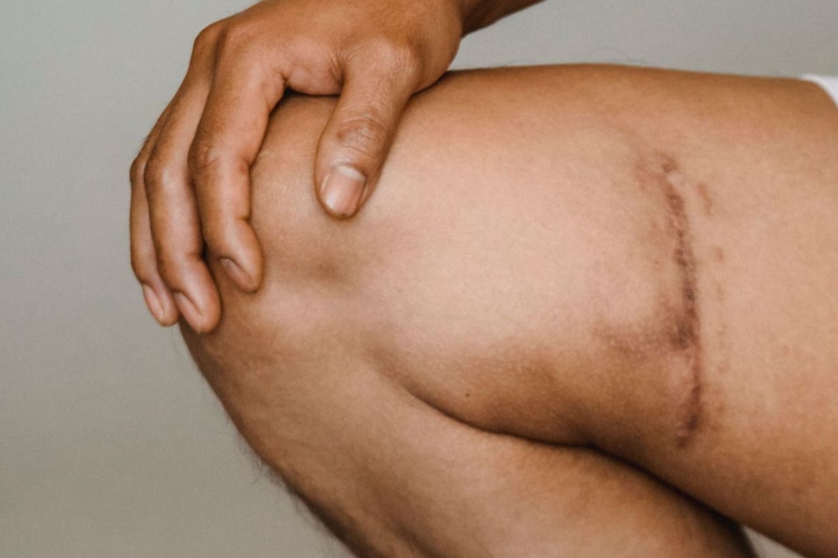 Cómo disimular cicatrices o manchas con maquillaje masculino