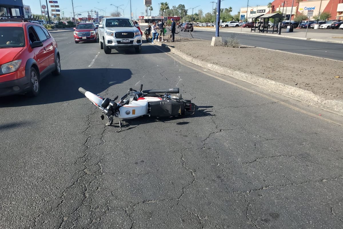 Motociclista pierde una pierna tras brutal accidente
