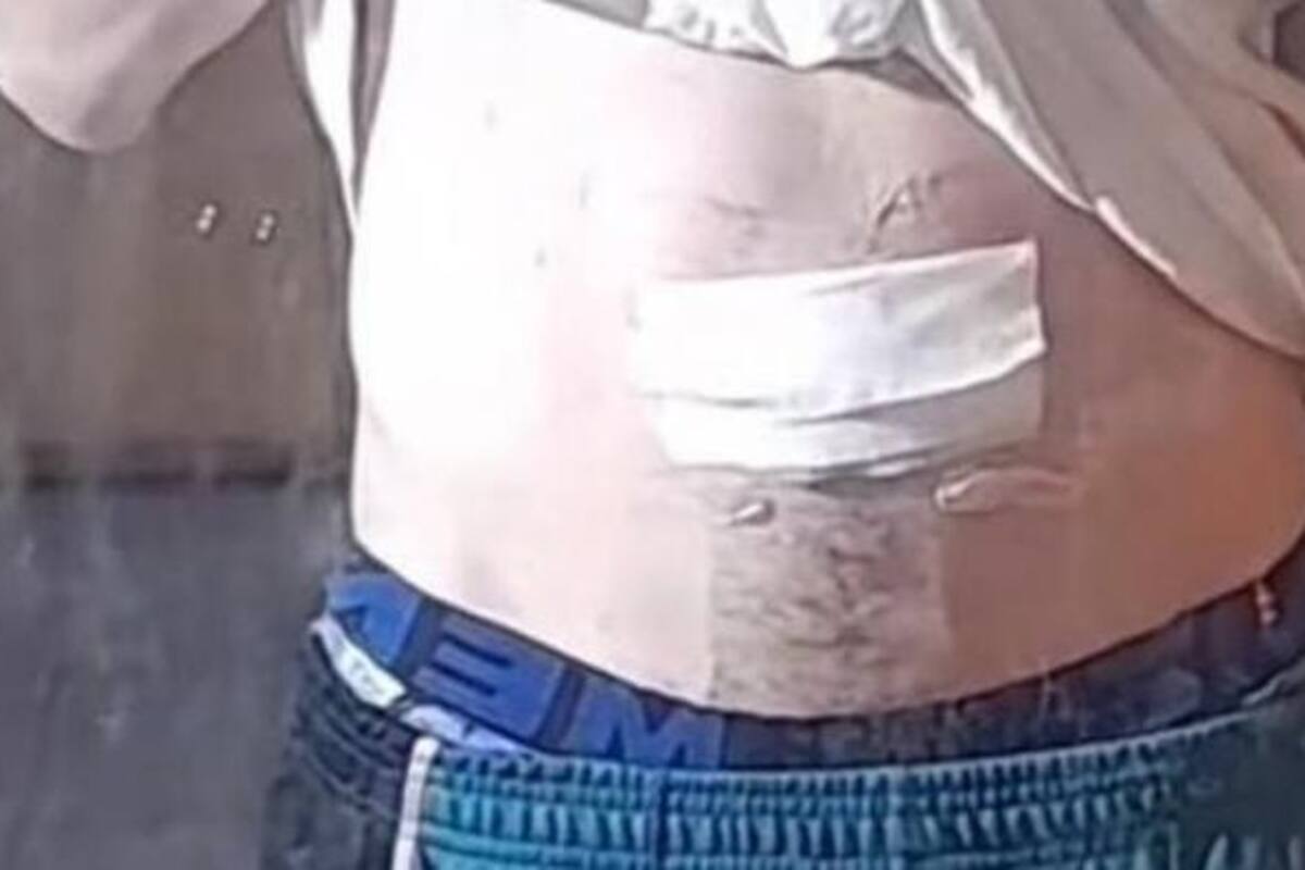 Joven se viraliza tras retirarse el ombligo: "solo sirve para acumular suciedad"