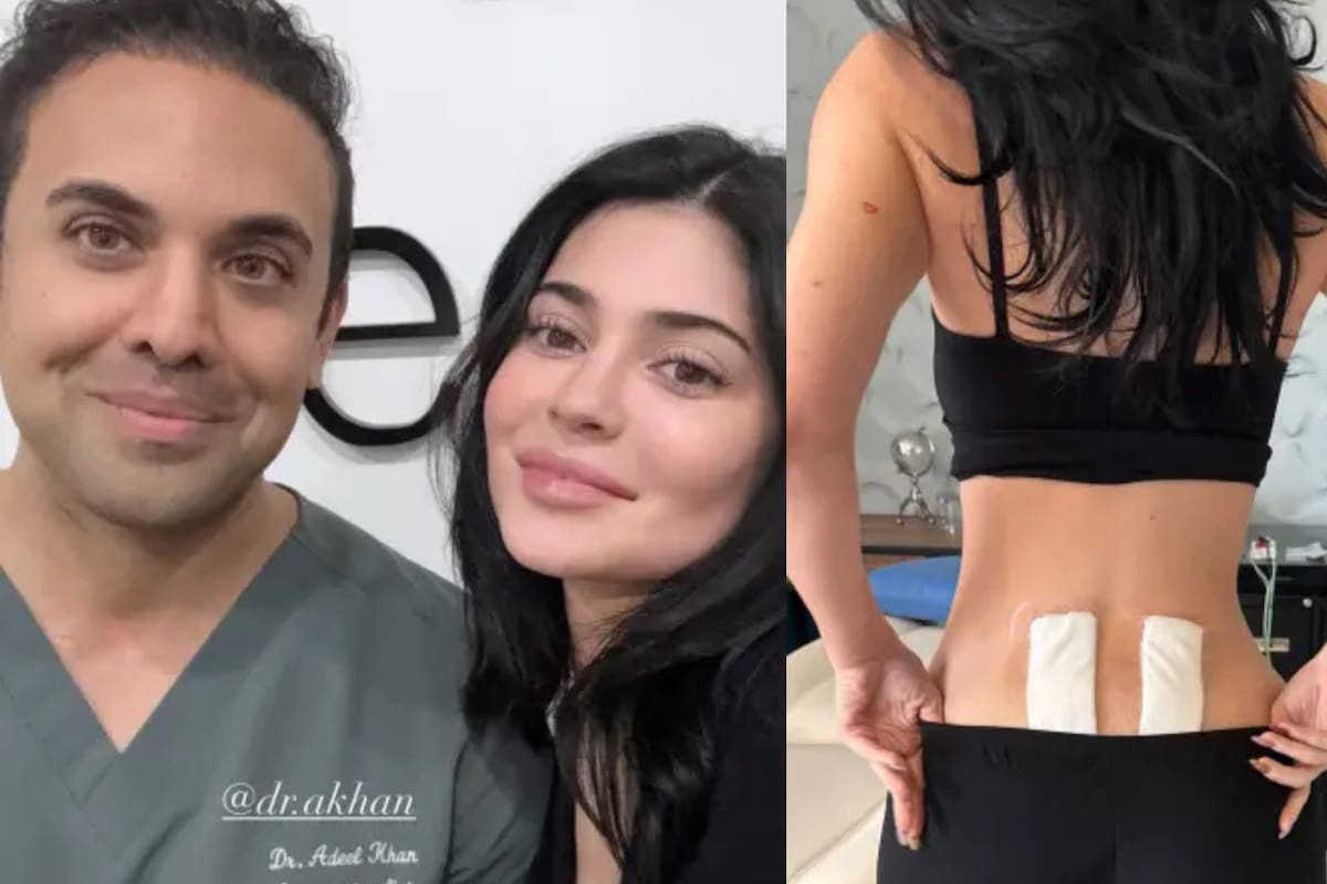 Kylie Jenner viaja a México para tratar dolor crónico: qué es la terapia con células madre y por qué no está disponible en EE.UU.