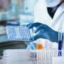 Impulsan detección de hepatitis C, VIH y sífilis en jóvenes