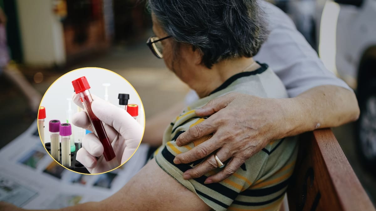 El análisis muestra si una persona con síntomas cognitivos tiene placas de amiloide en el cerebro. Su presencia ayuda a confirmar si se trata de Alzheimer. Foto: Especial