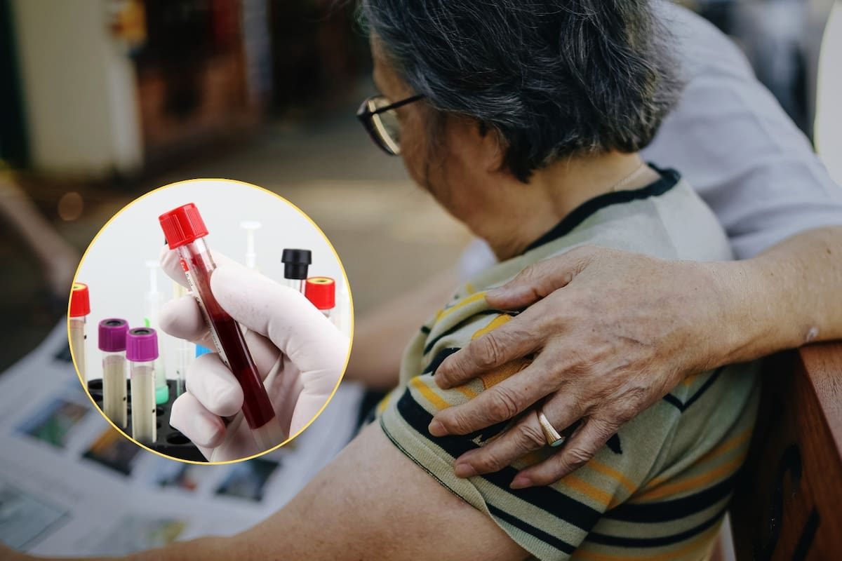 Nuevo análisis de sangre aprobado por la FDA podría transformar el diagnóstico y tratamiento del Alzheimer; los médicos podrán detectar con más precisión la enfermedad desde las primeras señales