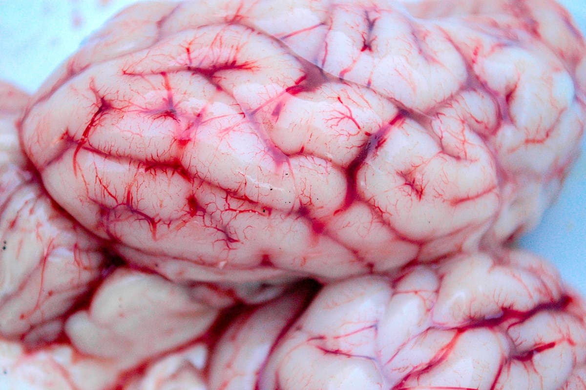 En el día mundial del Cerebro experto analiza las implicaciones del Covid-19 en este órgano vital